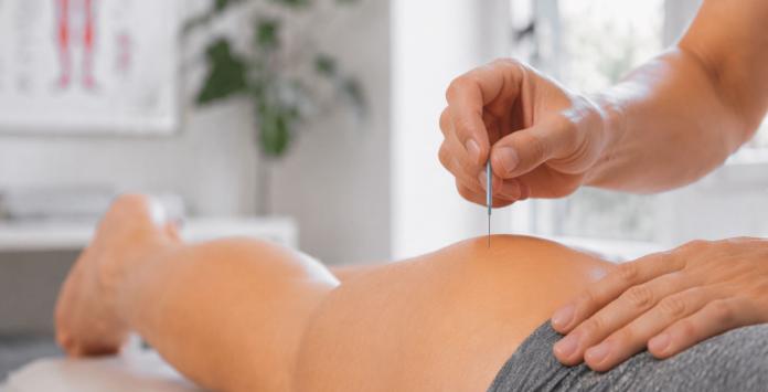 Onze Behandelingen: Dry needling